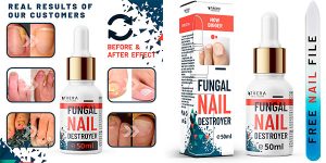 Chollo Tratamiento de hongos para las uñas Fungal Nail Destroyer de 50 ml