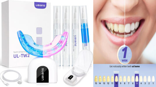 Chollo Blanqueador dental profesional Ualans con 32 LED