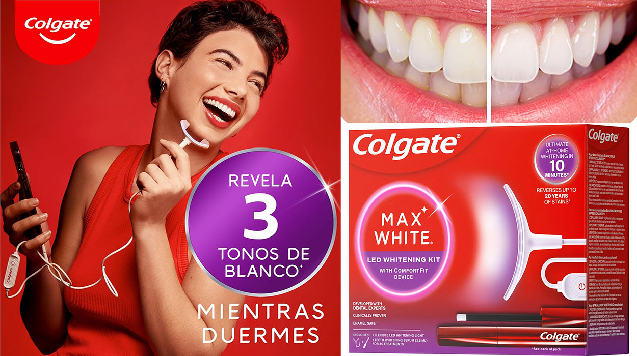 Chollo Kit de blanqueamiento dental LED Colgate Max White Ultimate