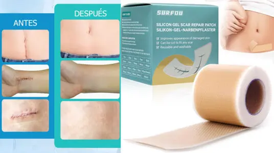 Chollo Parches de silicona Surfou para cicatrices en la piel
