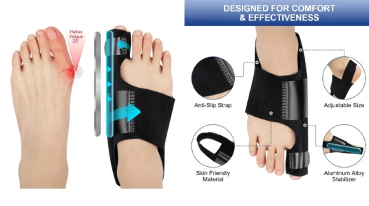 correctores de juanete ajustables