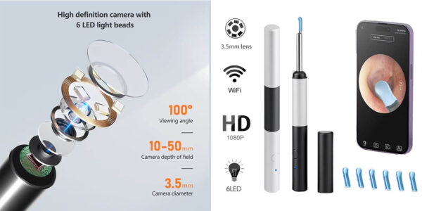 Otoscopio DDCAMERA P80